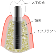 �l�k�@���쎕�Ȉ�@